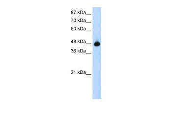 GTPBP9 Rabbit Polyclonal Antibody