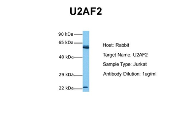 U2AF2 Rabbit Polyclonal Antibody