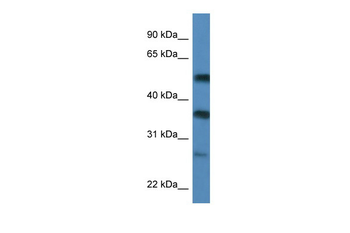 SERBP1 Rabbit Polyclonal Antibody