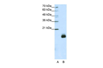 RPS14 Rabbit Polyclonal Antibody