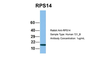 RPS14 Rabbit Polyclonal Antibody