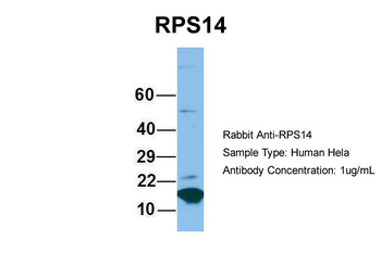 RPS14 Rabbit Polyclonal Antibody