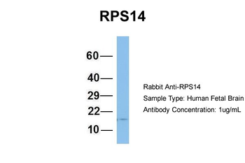 RPS14 Rabbit Polyclonal Antibody
