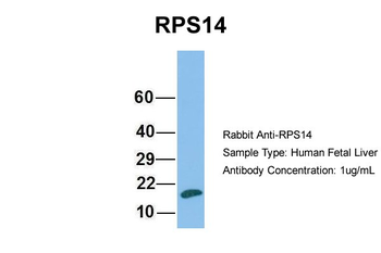 RPS14 Rabbit Polyclonal Antibody