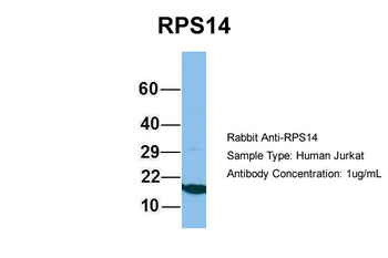 RPS14 Rabbit Polyclonal Antibody