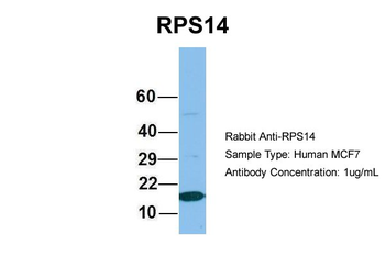 RPS14 Rabbit Polyclonal Antibody