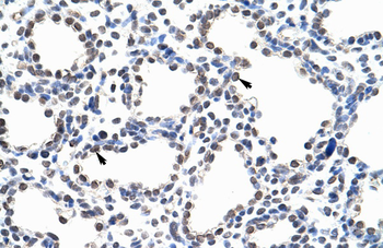 PUM3 Rabbit Polyclonal Antibody