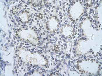 PUM3 Rabbit Polyclonal Antibody