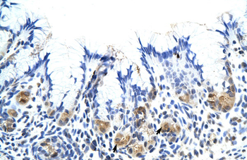 CSH1 Rabbit Polyclonal Antibody