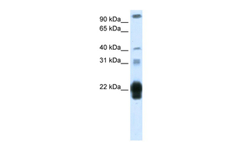 CSH1 Rabbit Polyclonal Antibody