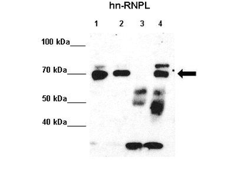 HNRPL Rabbit Polyclonal Antibody