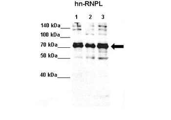HNRPL Rabbit Polyclonal Antibody