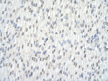 HNRPL Rabbit Polyclonal Antibody