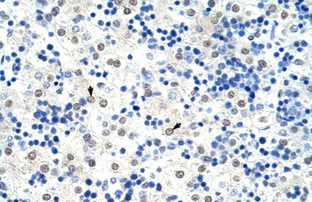 HNRPL Rabbit Polyclonal Antibody
