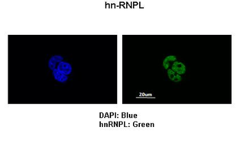 HNRPL Rabbit Polyclonal Antibody