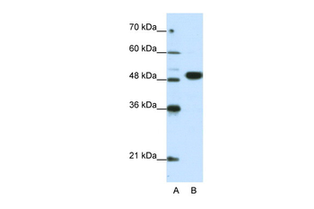 EIF4A2 Rabbit Polyclonal Antibody