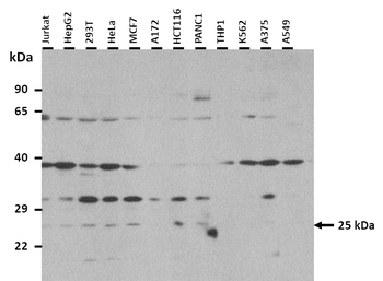 EIF4E Rabbit Polyclonal Antibody