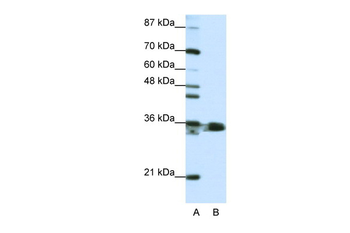HNRPA1 Rabbit Polyclonal Antibody