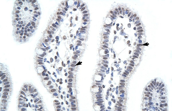 HNRPA1 Rabbit Polyclonal Antibody
