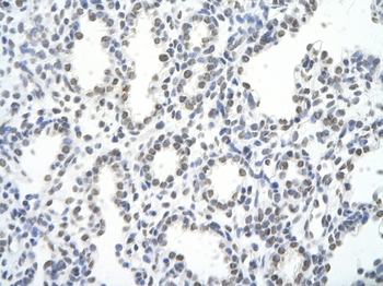 HNRPA1 Rabbit Polyclonal Antibody