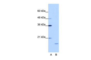 ISG20 Rabbit Polyclonal Antibody