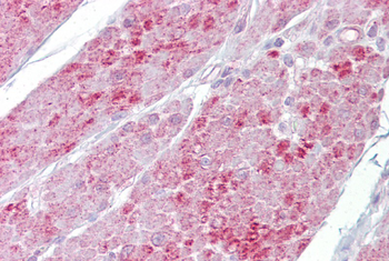 OAS1 Rabbit Polyclonal Antibody