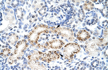 PPP1R8 Rabbit Polyclonal Antibody