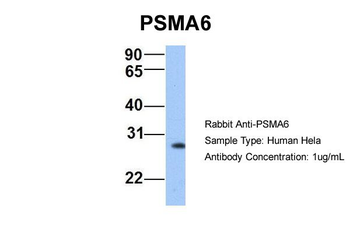 PSMA6 Rabbit Polyclonal Antibody