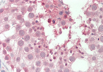 PSMA6 Rabbit Polyclonal Antibody