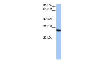 PSMA6 Rabbit Polyclonal Antibody