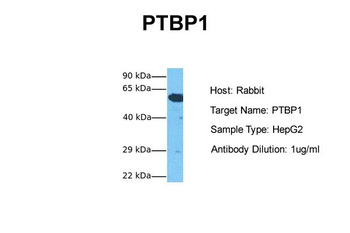 PTBP1 Rabbit Polyclonal Antibody