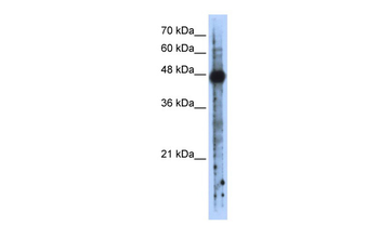 RBMS2 Rabbit Polyclonal Antibody