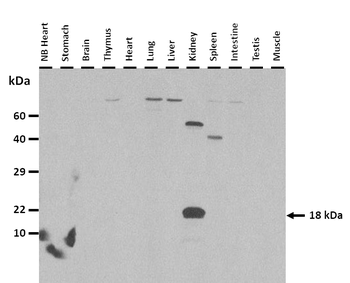 RNASE1 Rabbit Polyclonal Antibody