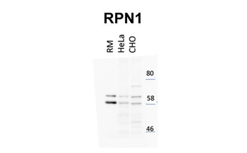 RPN1 Rabbit Polyclonal Antibody