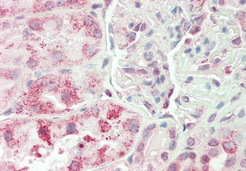 RPN1 Rabbit Polyclonal Antibody