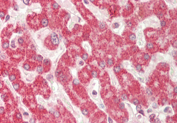 RPN1 Rabbit Polyclonal Antibody