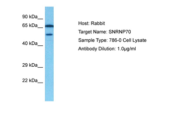 SNRP70 Rabbit Polyclonal Antibody