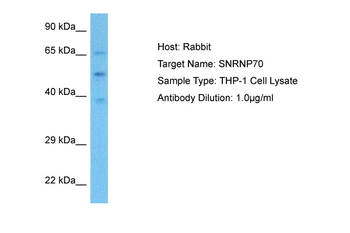 SNRP70 Rabbit Polyclonal Antibody
