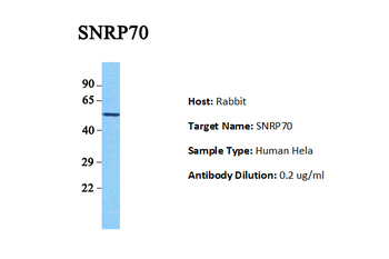SNRP70 Rabbit Polyclonal Antibody