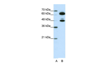 SNRP70 Rabbit Polyclonal Antibody