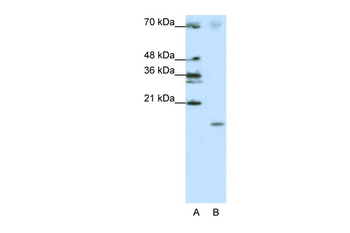 SRP19 Rabbit Polyclonal Antibody