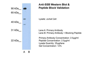 SSB Rabbit Polyclonal Antibody
