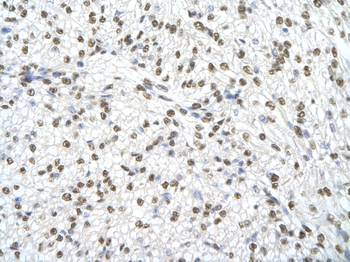 SSB Rabbit Polyclonal Antibody