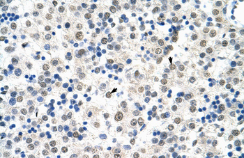 HSP90B1 Rabbit Polyclonal Antibody