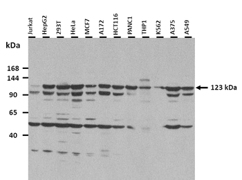 XPO1 Rabbit Polyclonal Antibody