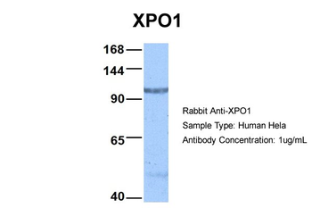 XPO1 Rabbit Polyclonal Antibody
