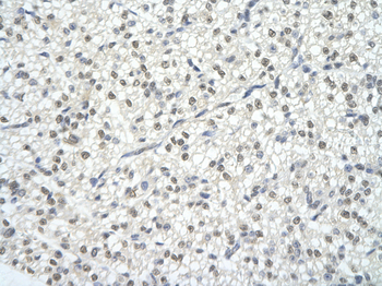 XPO1 Rabbit Polyclonal Antibody