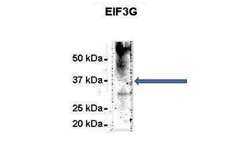 EIF3G Rabbit Polyclonal Antibody