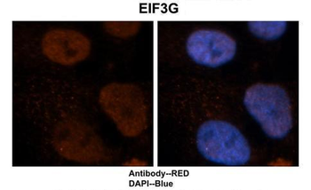EIF3G Rabbit Polyclonal Antibody