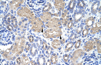 EIF3S4 Rabbit Polyclonal Antibody